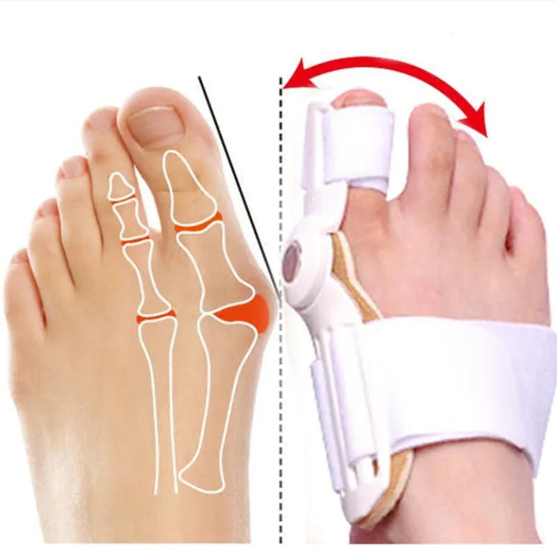 Adjustable Big Toe Alignment Support for Men & Women – Comfortable Toe Positioning Brace